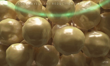 640_wx_fmt=gif&from=appmsg&wxfrom=5&wx_lazy=1 (2).gif