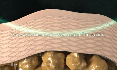 640_wx_fmt=gif&from=appmsg&wxfrom=5&wx_lazy=1 (4).gif
