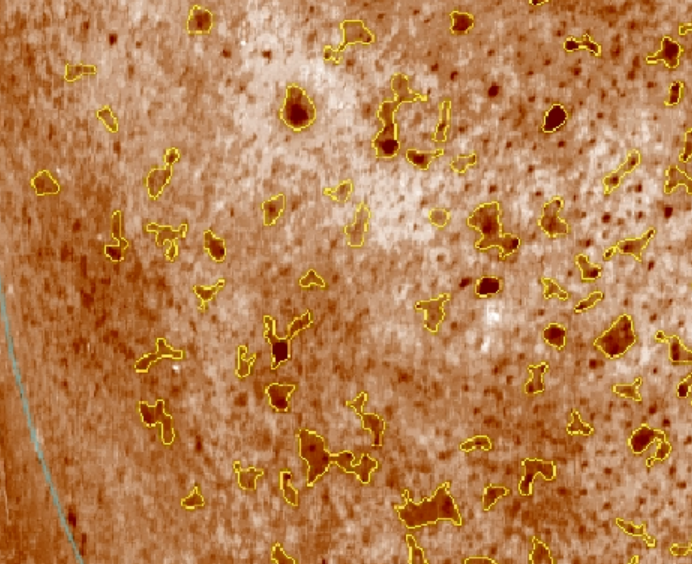 640_wx_fmt=png&from=appmsg&wxfrom=5&wx_lazy=1&wx_co=1 (7).png